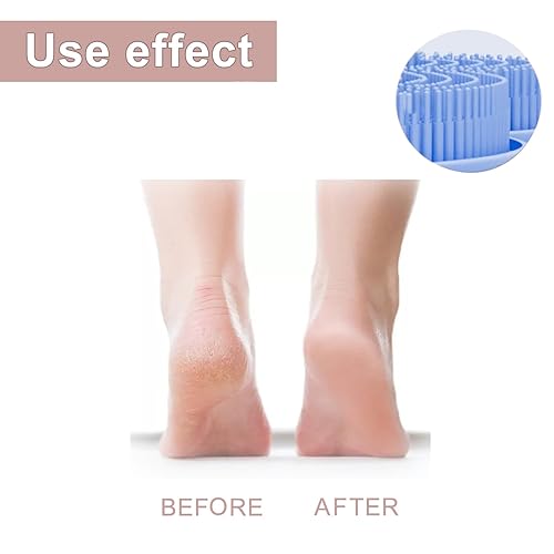 Shower Foot Scrubber,Shower Back Scrubber with Hook,Foot Washer with Suction Cups,Massager Cleaner Wash Brush(Blue) - Jamouz